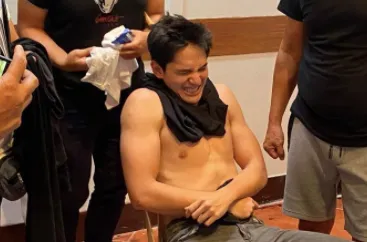 OH NO! Ruru Madrid injured during filming